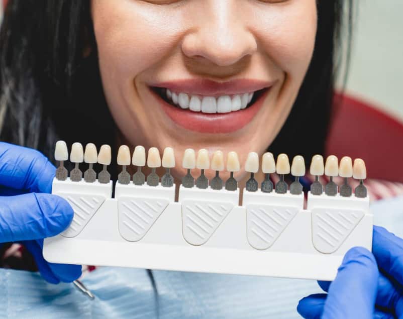 Advantages Of Hiring Dental Crowns At Gold Coast