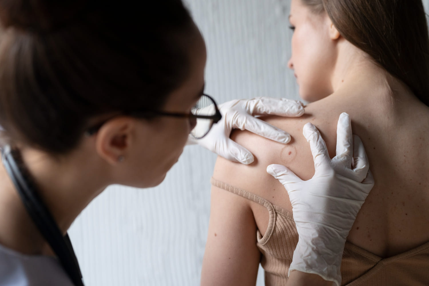 The Importance of Finding the Right Skin Cancer Doctor on the Gold Coast